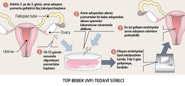 Tüp Bebek Tedavisi Süreci Nasıl Başlar?